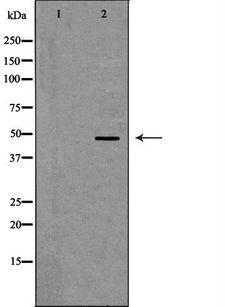 CASP1 / Caspase 1 Antibody - Western blot analysis of mouse Spleen tissue lysate using CASP1 antibody. The lane on the left is treated with the antigen-specific peptide.