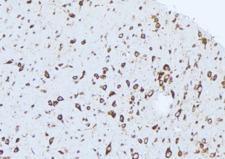 CASP1 / Caspase 1 Antibody - 1:100 staining mouse brain tissue by IHC-P. The sample was formaldehyde fixed and a heat mediated antigen retrieval step in citrate buffer was performed. The sample was then blocked and incubated with the antibody for 1.5 hours at 22°C. An HRP conjugated goat anti-rabbit antibody was used as the secondary.