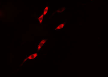 CASP1 / Caspase 1 Antibody - Staining 293 cells by IF/ICC. The samples were fixed with PFA and permeabilized in 0.1% Triton X-100, then blocked in 10% serum for 45 min at 25°C. The primary antibody was diluted at 1:200 and incubated with the sample for 1 hour at 37°C. An Alexa Fluor 594 conjugated goat anti-rabbit IgG (H+L) antibody, diluted at 1/600, was used as secondary antibody.