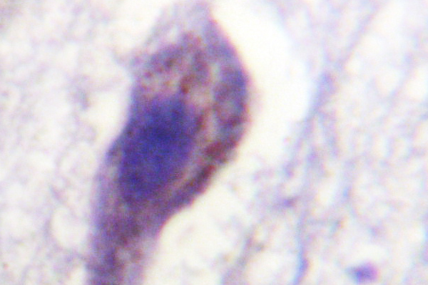 CASP1 / Caspase 1 Antibody - IHC of Caspase 1 (K372) pAb in paraffin-embedded human brain tissue.
