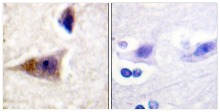 CASP1 / Caspase 1 Antibody - Immunohistochemistry analysis of paraffin-embedded human brain, using Caspase 1 (Phospho-Ser376) Antibody. The picture on the right is blocked with the phospho peptide.