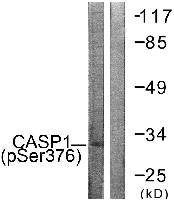 CASP1 / Caspase 1 Antibody - Western blot analysis of lysates from 293 cells, using Caspase 1 (Phospho-Ser376) Antibody. The lane on the right is blocked with the phospho peptide.