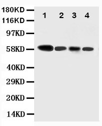 CASP10 / Caspase 10 Antibody - WB of CASP10 / Caspase 10 antibody. All lanes: Anti-CASP10 at 0.5ug/ml. Lane 1: COLO320 Whole Cell Lysate at 40ug. Lane 2: HELA Whole Cell Lysate at 40ug. Lane 3: SW620 Whole Cell Lysate at 40ug. Lane 4: RAJI Whole Cell Lysate at 40ug. Predicted bind size: 59KD. Observed bind size: 59KD.