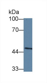 CASP10 / Caspase 10 Antibody - Western Blot; Sample: Mouse Spleen lysate; Primary Ab: 5µg/ml Rabbit Anti-Human CASP10 Antibody Second Ab: 0.2µg/mL HRP-Linked Caprine Anti-Rabbit IgG Polyclonal Antibody