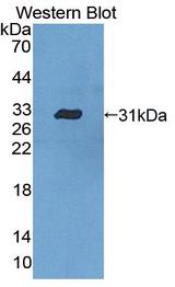 CASP10 / Caspase 10 Antibody - Western blot of CASP10 / Caspase 10 antibody.