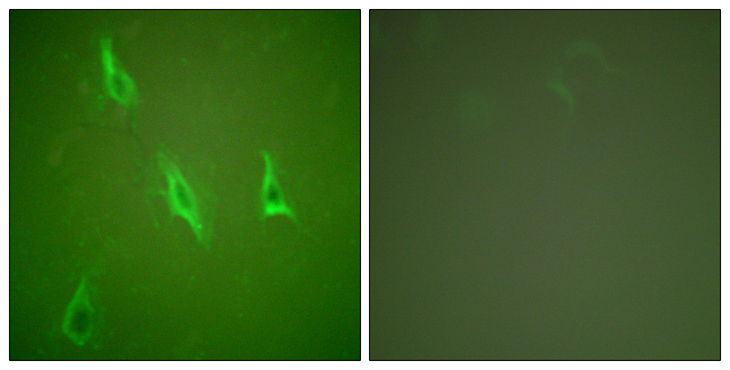 CASP10 / Caspase 10 Antibody - Immunofluorescence analysis of HeLa cells, using Caspase 10 Antibody. The picture on the right is blocked with the synthesized peptide.