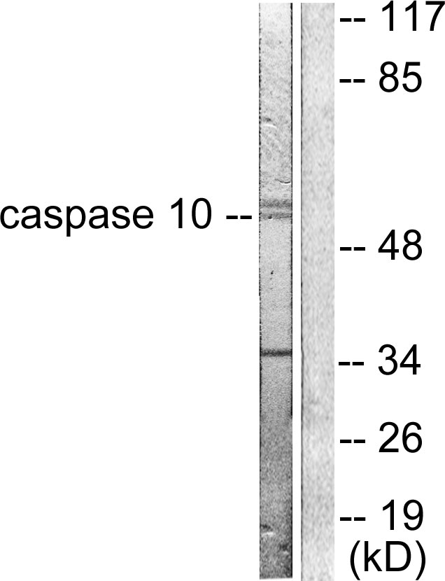CASP10 / Caspase 10 Antibody - Western blot analysis of lysates from HeLa cells, using Caspase 10 Antibody. The lane on the right is blocked with the synthesized peptide.