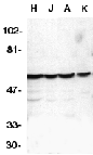 CASP10 / Caspase 10 Antibody - Western blot analysis of Caspase-10 in HeLa (H), Jurkat (J), A431 (A), K562 (K) whole cell lysates with Caspase-10 antibody at 1µg/ml.