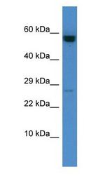 CASP10 / Caspase 10 Antibody - CASP10 / Caspase 10 antibody Western Blot of HCT15. Antibody dilution: 1 ug/ml.  This image was taken for the unconjugated form of this product. Other forms have not been tested.