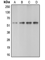 CASP10 / Caspase 10 Antibody - Western blot analysis of Caspase 10 expression in HeLa (A); Jurkat (B); mouse heart (C); rat heart (D) whole cell lysates.