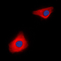 CASP10 / Caspase 10 Antibody - Immunofluorescent analysis of Caspase 10 staining in Jurkat cells. Formalin-fixed cells were permeabilized with 0.1% Triton X-100 in TBS for 5-10 minutes and blocked with 3% BSA-PBS for 30 minutes at room temperature. Cells were probed with the primary antibody in 3% BSA-PBS and incubated overnight at 4 C in a humidified chamber. Cells were washed with PBST and incubated with a DyLight 594-conjugated secondary antibody (red) in PBS at room temperature in the dark. DAPI was used to stain the cell nuclei (blue).