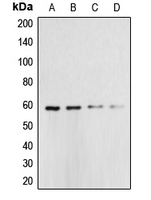CASP10 / Caspase 10 Antibody - Western blot analysis of Caspase 10 expression in HeLa (A); Jurkat (B); A431 (C); K562 (D) whole cell lysates.