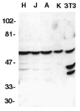 CASP10 / Caspase 10 Antibody - Western blot of caspase-10 in HeLa (H), Jurkat (J), A431 (A), K562 (K), and NIH3T3 (3T3) whole cell lysates with Caspase-10 antibody at 1:1000 dilution.