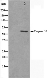 CASP10 / Caspase 10 Antibody - Western blot analysis on HeLa cell lysates using Caspase 10 antibody. The lane on the left is treated with the antigen-specific peptide.