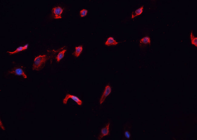 CASP10 / Caspase 10 Antibody - Staining A431 cells by IF/ICC. The samples were fixed with PFA and permeabilized in 0.1% Triton X-100, then blocked in 10% serum for 45 min at 25°C. The primary antibody was diluted at 1:200 and incubated with the sample for 1 hour at 37°C. An Alexa Fluor 594 conjugated goat anti-rabbit IgG (H+L) antibody, diluted at 1/600, was used as secondary antibody.