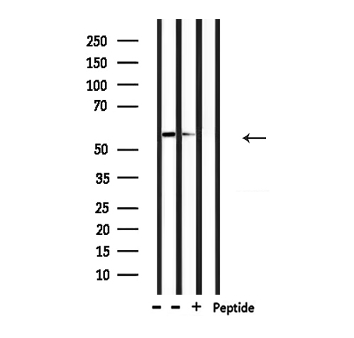 CASP10 / Caspase 10 Antibody - Western blot analysis of extracts of mouse brain and HepG2 cells using Caspase 10 antibody.