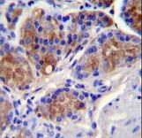 CASP12 / Caspase 12 Antibody - CASP12 Antibody immunohistochemistry of formalin-fixed and paraffin-embedded human stomach tissue followed by peroxidase-conjugated secondary antibody and DAB staining.