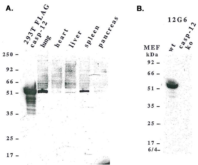CASP12 / Caspase 12 Antibody - Western blot analysis using anti-caspase-12 (mouse), mAb (12G6) detecting, A) endogenous caspase-12 in mouse lung, liver, spleen and pancreas, and B) pro-caspase-12 in mouse MEF's.
