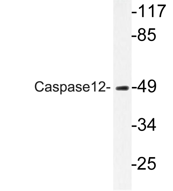 CASP12 / Caspase 12 Antibody - Western blot analysis of lysate from HUVEC cells, using Caspase12 antibody.