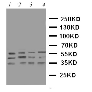 CASP12 / Caspase 12 Antibody - WB of CASP12 / Caspase 12 antibody. Lane 1: PANC Cell Lysate. Lane 2: SMMC Cell Lysate. Lane 3: A549 Cell Lysate. Lane 4: HELA Cell Lysate.