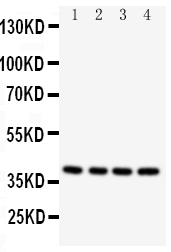 CASP12 / Caspase 12 Antibody - Anti-Caspase-12 antibody, Western blotting All lanes: Anti Caspase-12 at 0.5ug/ml Lane 1: PANC Whole Cell Lysate at 40ug Lane 2: SMMC Whole Cell Lysate at 40ug Lane 3: A549 Whole Cell Lysate at 40ug Lane 4: HELA Whole Cell Lysate at 40ug Predicted bind size: 39KD Observed bind size: 39KD