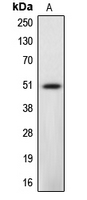 CASP12 / Caspase 12 Antibody - Western blot analysis of Caspase 12 expression in L929 (A) whole cell lysates.