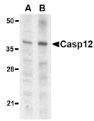 CASP12 / Caspase 12 Antibody - Western blot of caspase-12 in mouse (lane A) and rat (lane B) liver lysate with caspase-12 antibody at 1 ug/ml.