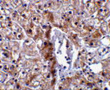 CASP12 / Caspase 12 Antibody - Immunohistochemical staining of human liver tissue using caspase-12 antibody (small) at 10 ug/mL.