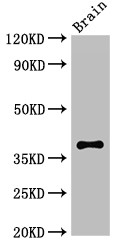 CASP12 / Caspase 12 Antibody - Positive WB detected in:Mouse brain tissue;All lanes:CASP12 antibody at 2.7?g/ml;Secondary;Goat polyclonal to rabbit IgG at 1/50000 dilution;Predicted band size: 39,20,30 KDa;Observed band size: 39 KDa;