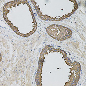 CASP12 / Caspase 12 Antibody - Immunohistochemistry of paraffin-embedded human prostate using CASP12 antibody at dilution of 1:100 (20x lens).