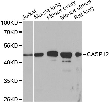 CASP12 / Caspase 12 Antibody - Western blot analysis of extracts of various cell lines, using CASP12 Antibody at 1:1000 dilution. The secondary antibody used was an HRP Goat Anti-Rabbit IgG (H+L) at 1:10000 dilution. Lysates were loaded 25ug per lane and 3% nonfat dry milk in TBST was used for blocking. An ECL Kit was used for detection and the exposure time was 90s.