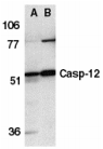 CASP12 / Caspase 12 Antibody - Western blot analysis of Caspase-12 in human (A) and mouse (B) spleen tissue lysates with Caspase-12 antibody at 1µg/ml.