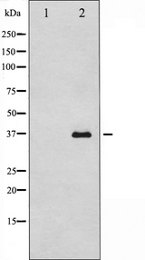CASP12 / Caspase 12 Antibody - Western blot analysis of caspase12 expression in HuvEc cells. The lane on the left is treated with the antigen-specific peptide.
