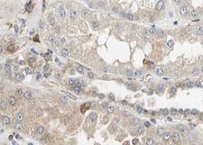 CASP12 / Caspase 12 Antibody - 1:100 staining human kidney tissue by IHC-P. The tissue was formaldehyde fixed and a heat mediated antigen retrieval step in citrate buffer was performed. The tissue was then blocked and incubated with the antibody for 1.5 hours at 22°C. An HRP conjugated goat anti-rabbit antibody was used as the secondary.