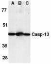 CASP13 / Caspase 13 Antibody - Western blot analysis of Caspase-13 in (A) HL60 cell lysate, (B) mouse brain and (C) rat brain tissue lysates with Caspase-13 antibody at 1µg/ml.
