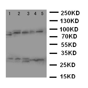 CASP14 / Caspase 14 Antibody - WB of CASP14 / Caspase 14 antibody. Lane 1: Rat Brain Tissue Lysate. Lane 2: Rat Liver Tissue Lysate. Lane 3: Rat Spleen Tissue Lysate. Lane 4: A431 Cell Lysate. Lane 5: NIH3T3 Cell Lysate..