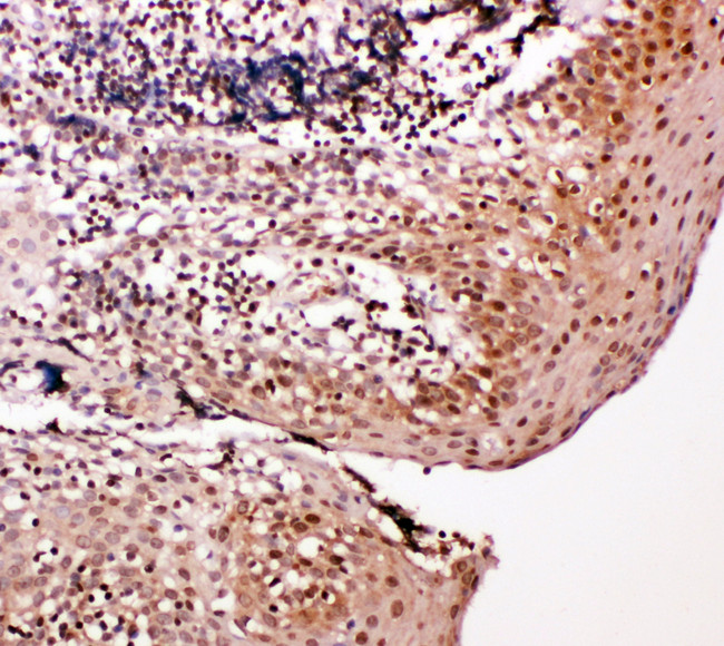 CASP14 / Caspase 14 Antibody - CASP14 / Caspase 14 antibody. IHC(P): Human Tonsil Tissue.