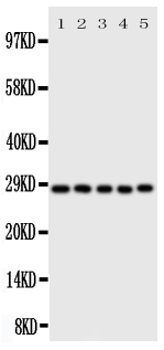 CASP14 / Caspase 14 Antibody - Anti-Caspase-14 antibody, Western blotting All lanes: Anti Caspase-14 at 0.5ug/ml Lane 1: Rat Brain Tissue Lysate at 50ug Lane 2: Rat Liver Tissue Lysate at 50ug Lane 3: Rat Spleen Tissue Lysate at 50ug Lane 4: A431 Whole Cell Lysate at 40ug Lane 5: NIH3T3 Whole Cell Lysate at 40ug Predicted bind size: 28KD Observed bind size: 28KD