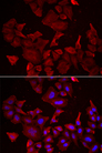 CASP14 / Caspase 14 Antibody - Immunofluorescence analysis of HeLa cells.