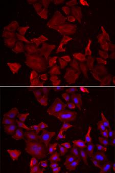 CASP14 / Caspase 14 Antibody - Immunofluorescence analysis of HeLa cells.