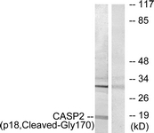 CASP2 / Caspase 2 Antibody - Western blot of extracts from Jurkat cells, treated with etoposide 25 uM 24h, using Caspase 2 (p18, Cleaved-Gly170) Antibody. The lane on the right is treated with the synthesized peptide.