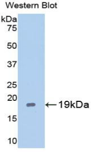 CASP2 / Caspase 2 Antibody - Western blot of recombinant CASP2 / Caspase 2.  This image was taken for the unconjugated form of this product. Other forms have not been tested.