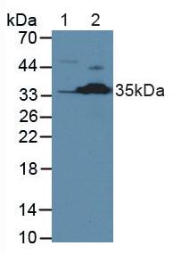 CASP2 / Caspase 2 Antibody - Western Blot; Sample: Lane1: Human Jurkat Cells; Lane2: Mouse Kidney Tissue.