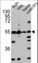 CASP2 / Caspase 2 Antibody - Western blot of CASP2 antibody in HL60, K562, Ramos and NIH-3T3 cell line lysates(35 ug/lane). CASP2 (arrow) was detected using the purified antibody.