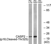 CASP2 / Caspase 2 Antibody - Western blot of extracts from rat heart/rat lung cells, using Caspase 2 (p18, Cleaved-Thr325) Antibody. The lane on the right is treated with the synthesized peptide.