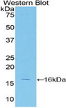 CASP2 / Caspase 2 Antibody - Western blot of recombinant CASP2 / Caspase 2.  This image was taken for the unconjugated form of this product. Other forms have not been tested.