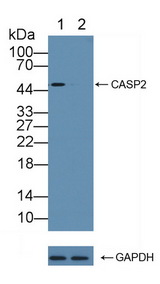 CASP2 / Caspase 2 Antibody - Knockout Varification: Lane 1: Wild-type Jurkat cell lysate; Lane 2: CASP2 knockout Jurkat cell lysate; Predicted MW: 10,35,51kd Observed MW: 51kd Primary Ab: 1µg/ml Rabbit Anti-Human CASP2 Antibody Second Ab: 0.2µg/mL HRP-Linked Caprine Anti-Rabbit IgG Polyclonal Antibody