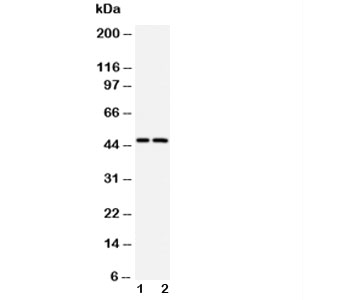 CASP2 / Caspase 2 Antibody - Western blot testing of Caspase-2 antibody and Lane 1: CEM; 2: SMMC-7721 cell lysate