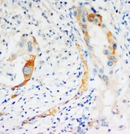 CASP2 / Caspase 2 Antibody -  This image was taken for the unconjugated form of this product. Other forms have not been tested.