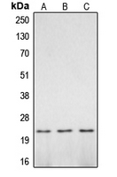 CASP2 / Caspase 2 Antibody - Western blot analysis of Caspase 2 p18 expression in mouse brain (A); rat brain (B); PC12 UV-treated (C) whole cell lysates.
